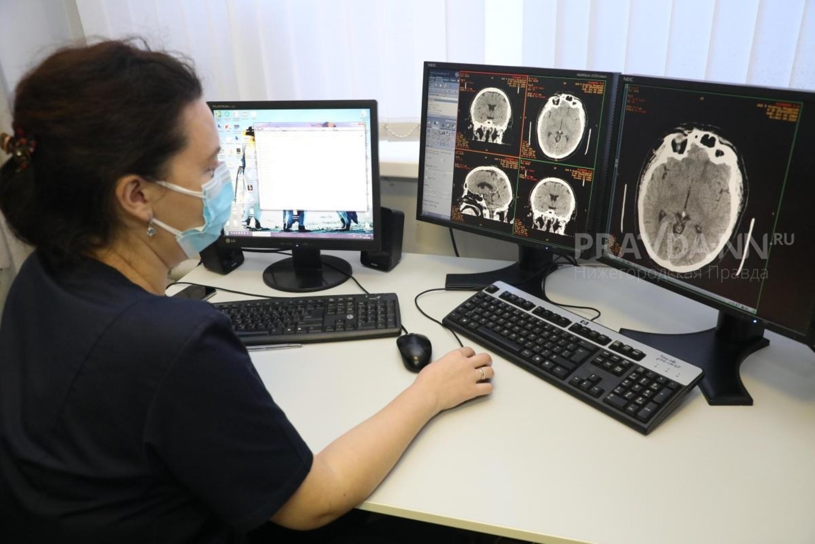 Нижегородские ученые нашли новый метод лечения эпилепсии