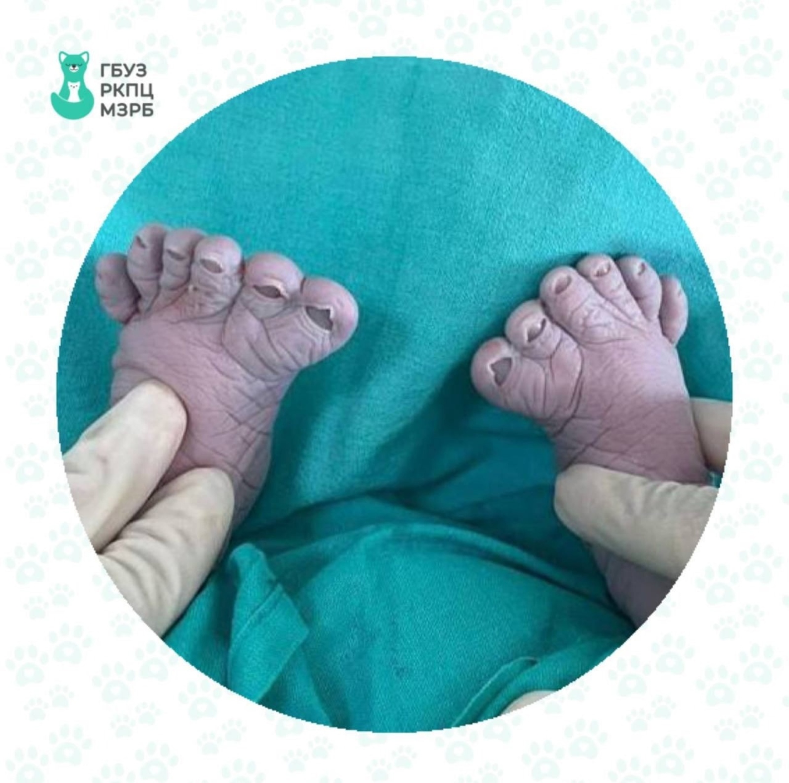 В Башкирии женщина родила третьего ребенка с лишними пальцами на ножках