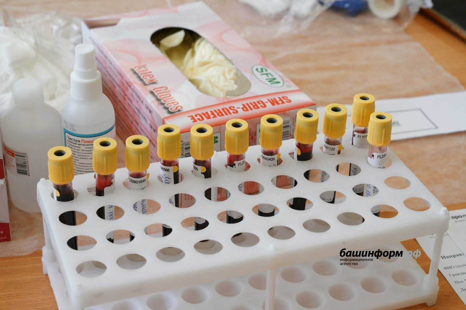 В России создали первый в мире экспресс-тест на гепатит С