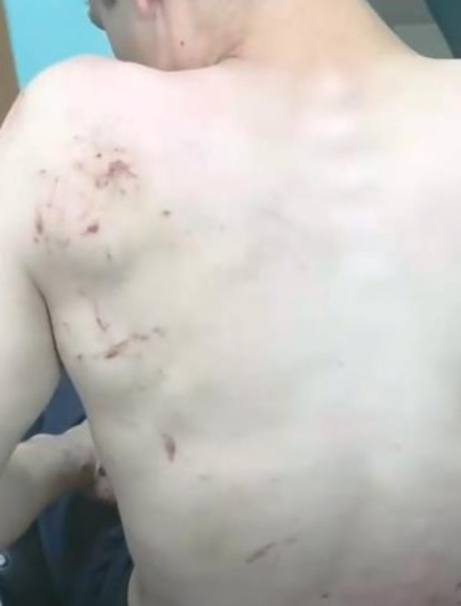 В Башкирии друзья устроили разборки из-за сломанного скутера