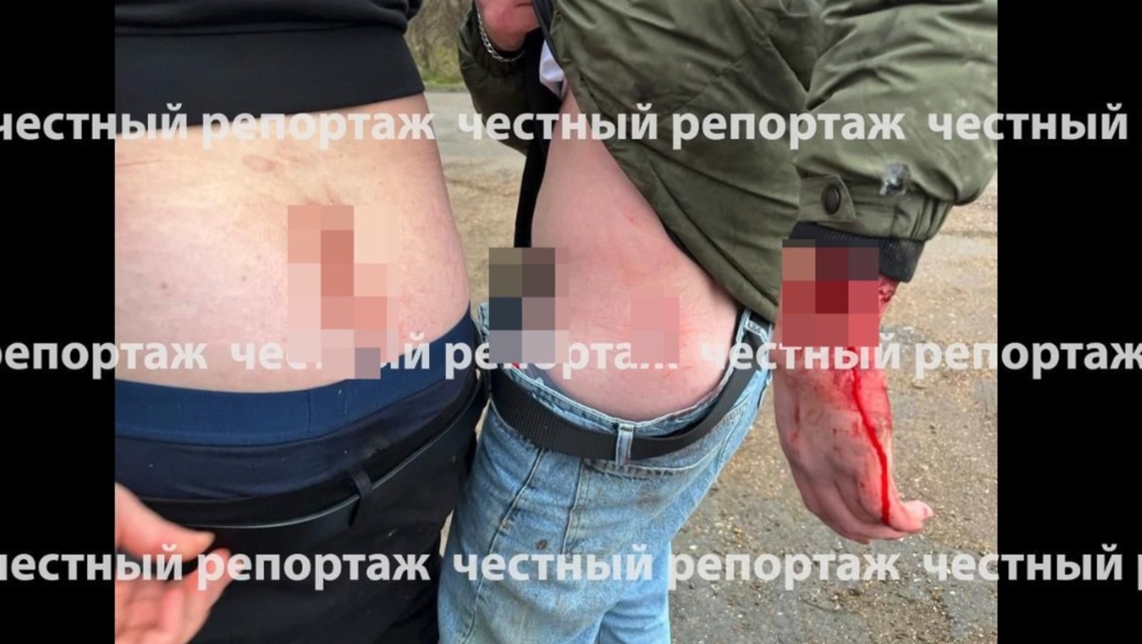 В МВД Башкирии прокомментировали инцидент с ранеными парнями на озере