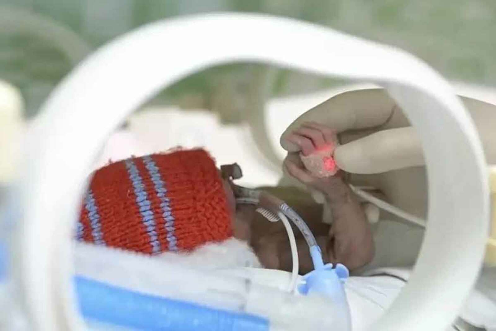 Врачи в Башкирии выходили малышку весом 480 грамм